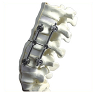 Spine Implants, Spinal System India